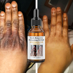 Niacinamide Knuckle & Body Care Serum 30ml